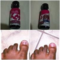 Nail Fungus Treatment - Sweet Jamaica Shopping